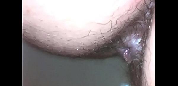  Amazing endoscope dirty asshole exploration and pee are you ready